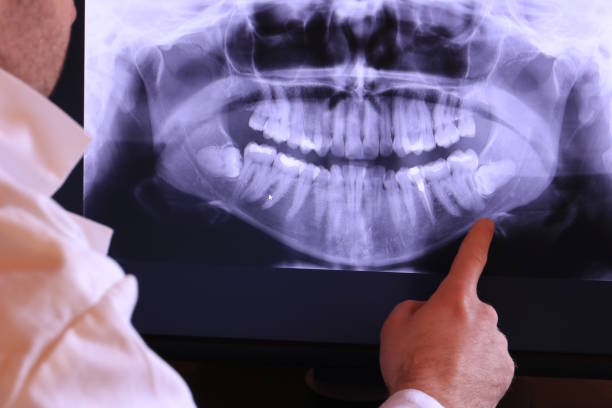Best Emergency Dental Care for Sports Injuries in Plymouth, NC