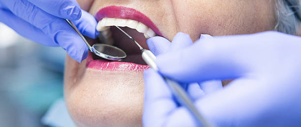 Best Dental Abscess Treatment in Plymouth, NC
